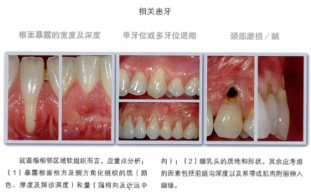 患牙条件.JPG