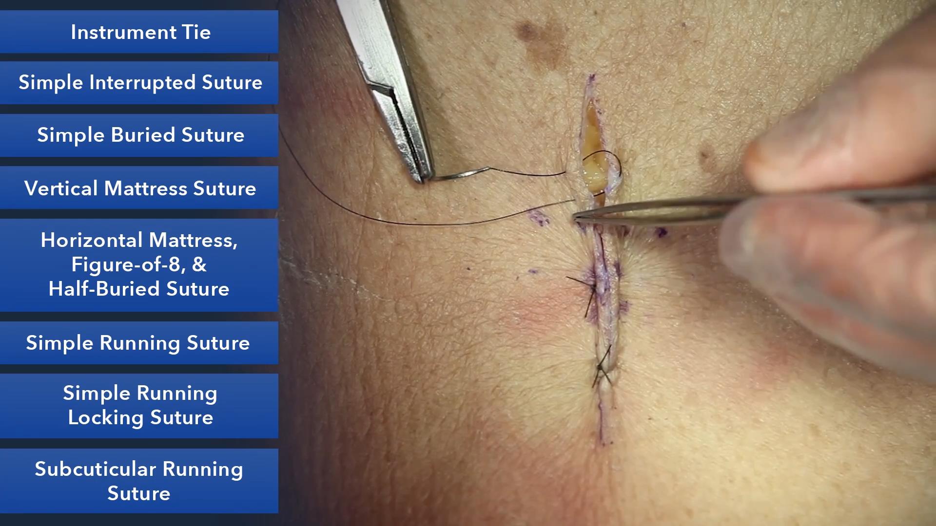 Duke_Suture_Skills_Course_1080p_20210830205351