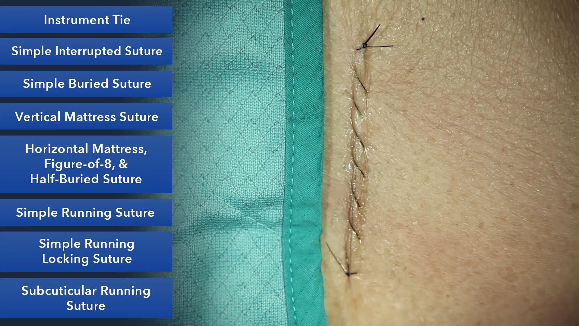 Duke_Suture_Skills_Course_1080p_20210830210150