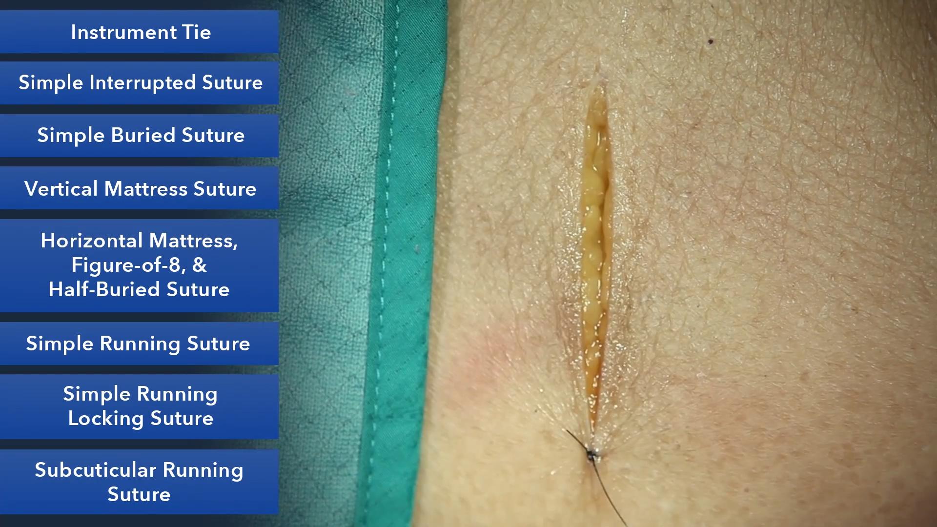 Duke_Suture_Skills_Course_1080p_20210830210335