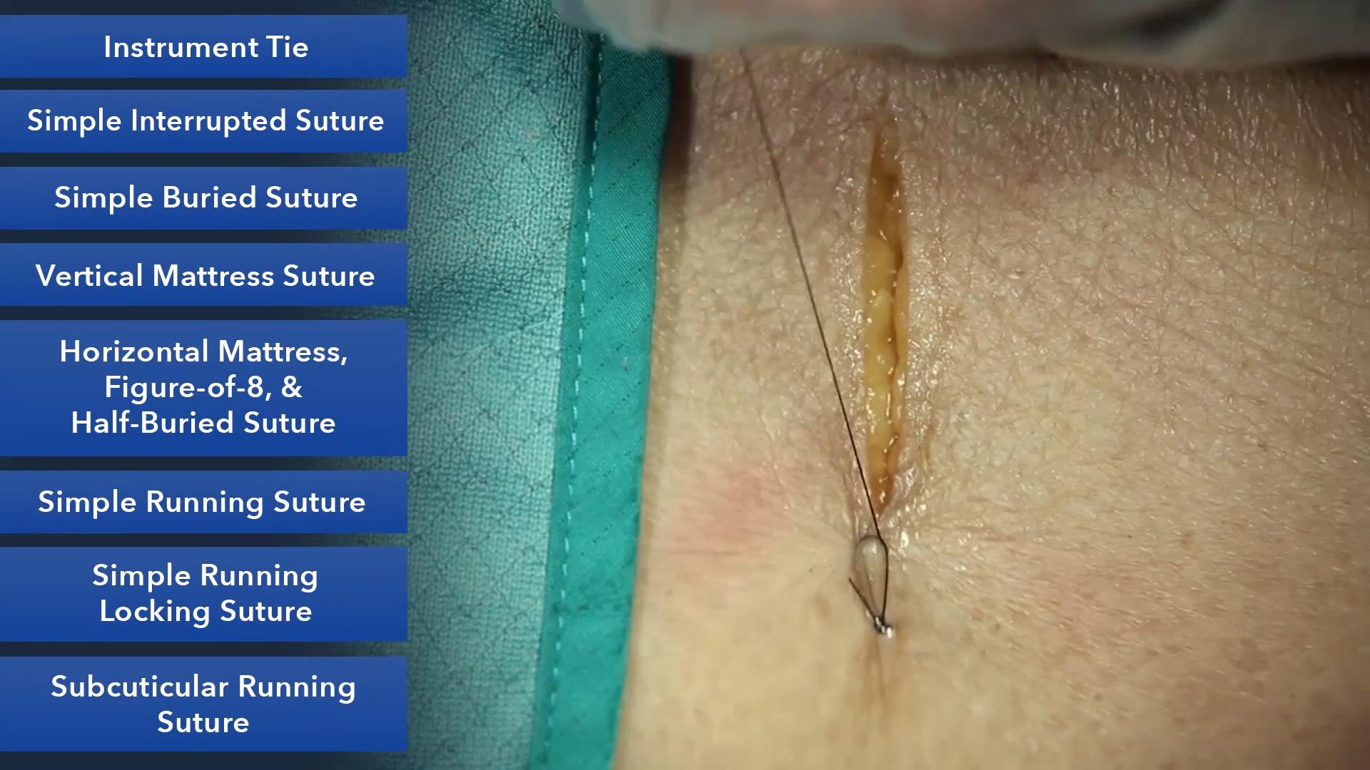 Duke_Suture_Skills_Course_1080p_20210830210530