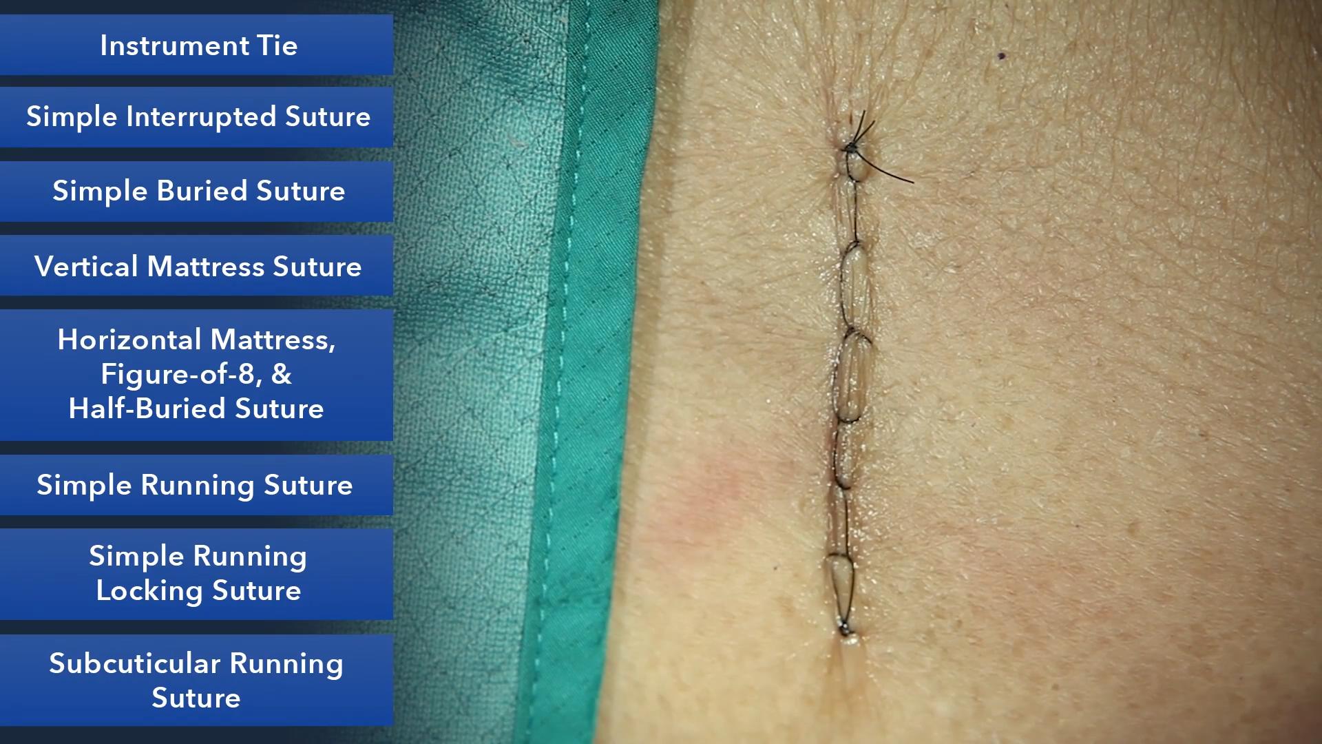 Duke_Suture_Skills_Course_1080p_20210830210904