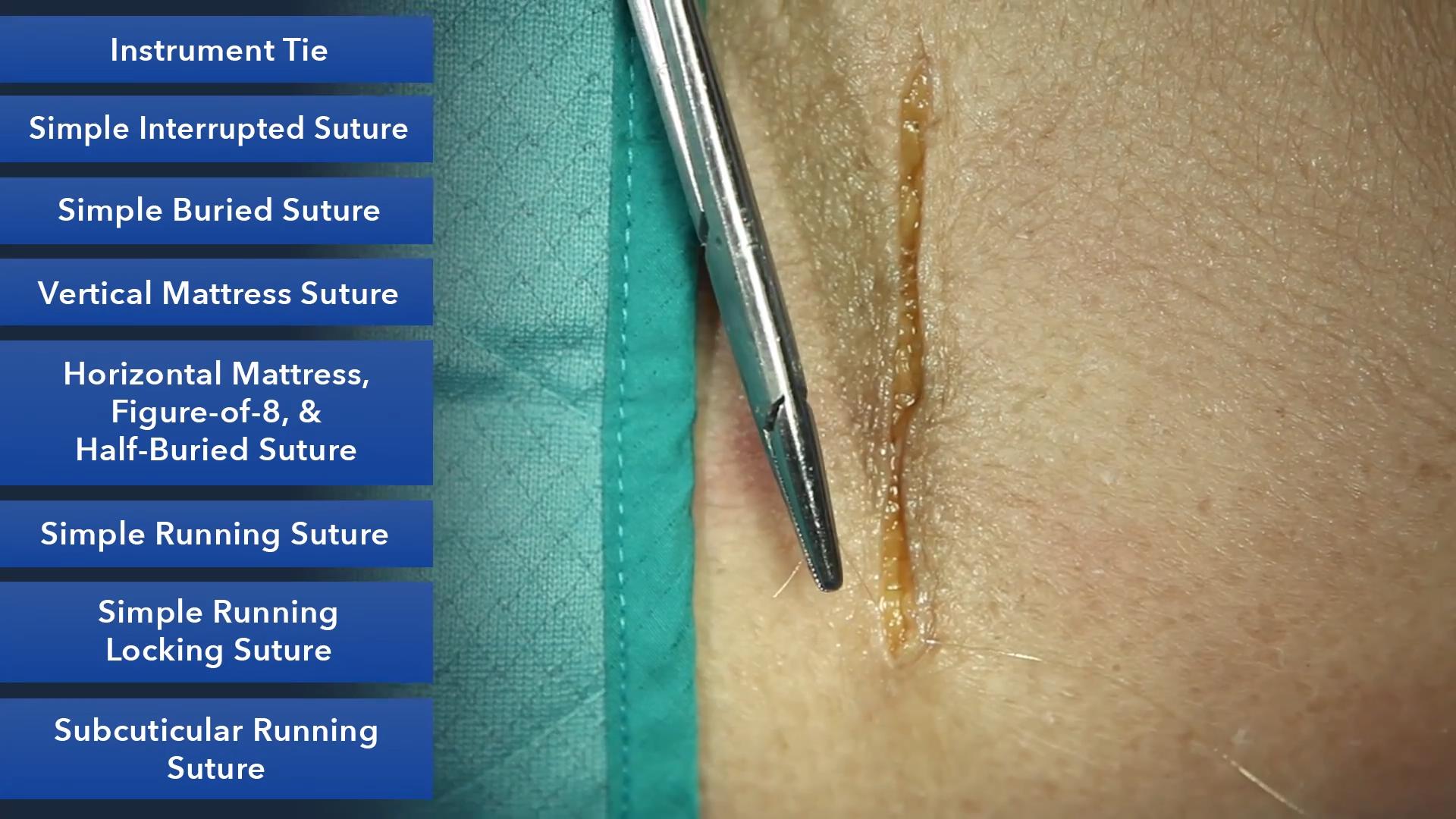Duke_Suture_Skills_Course_1080p_20210830211235