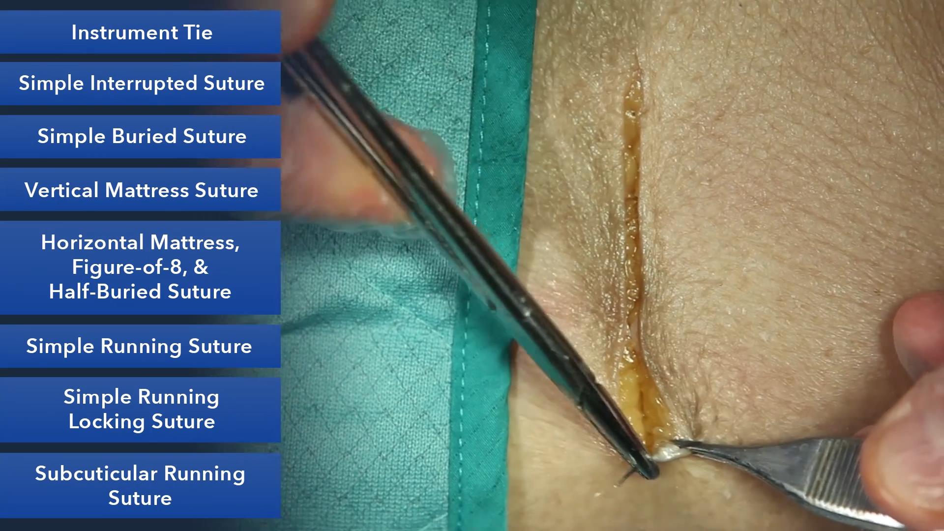 Duke_Suture_Skills_Course_1080p_20210830211336