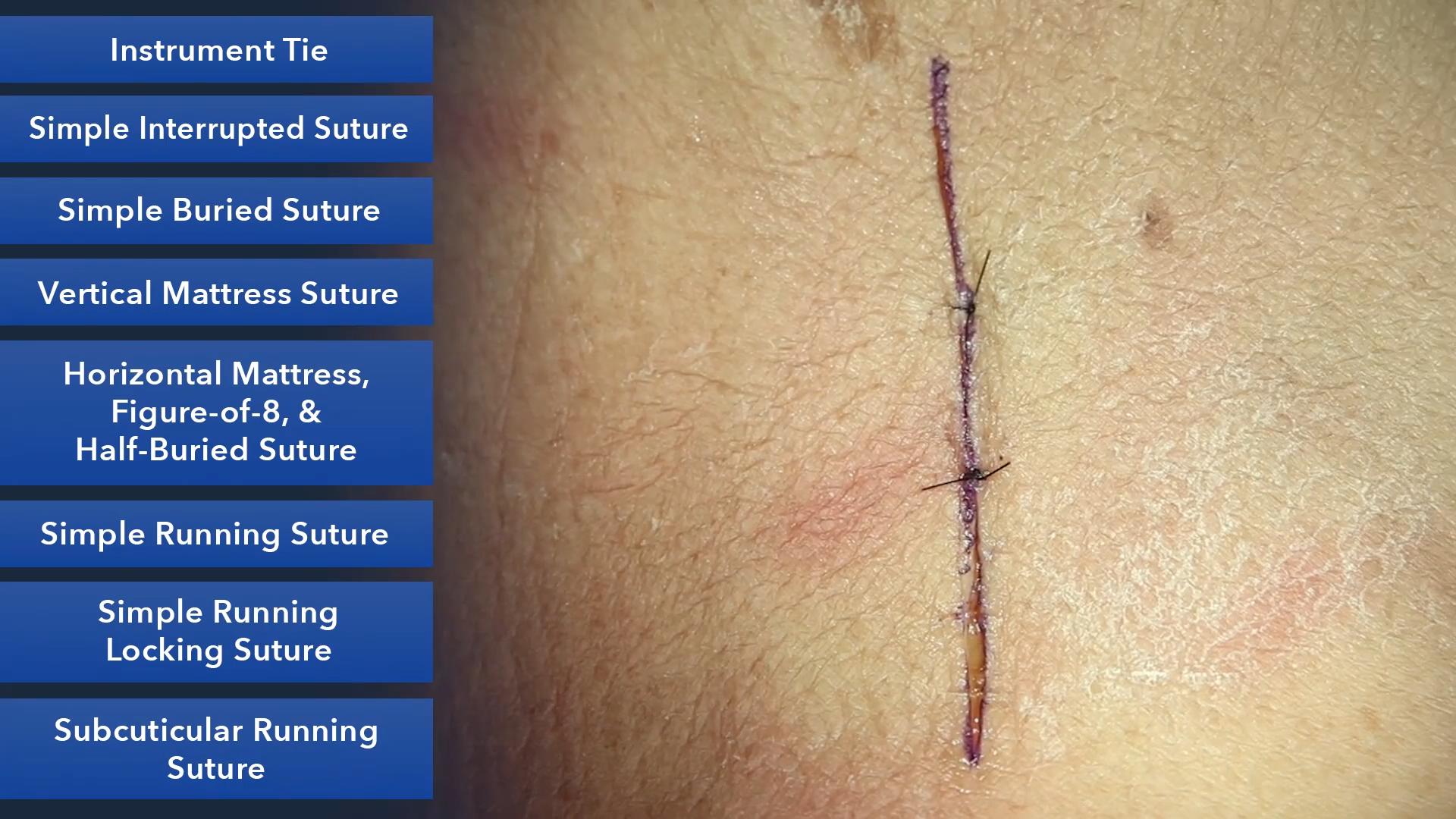 Duke_Suture_Skills_Course_1080p_20210830201852