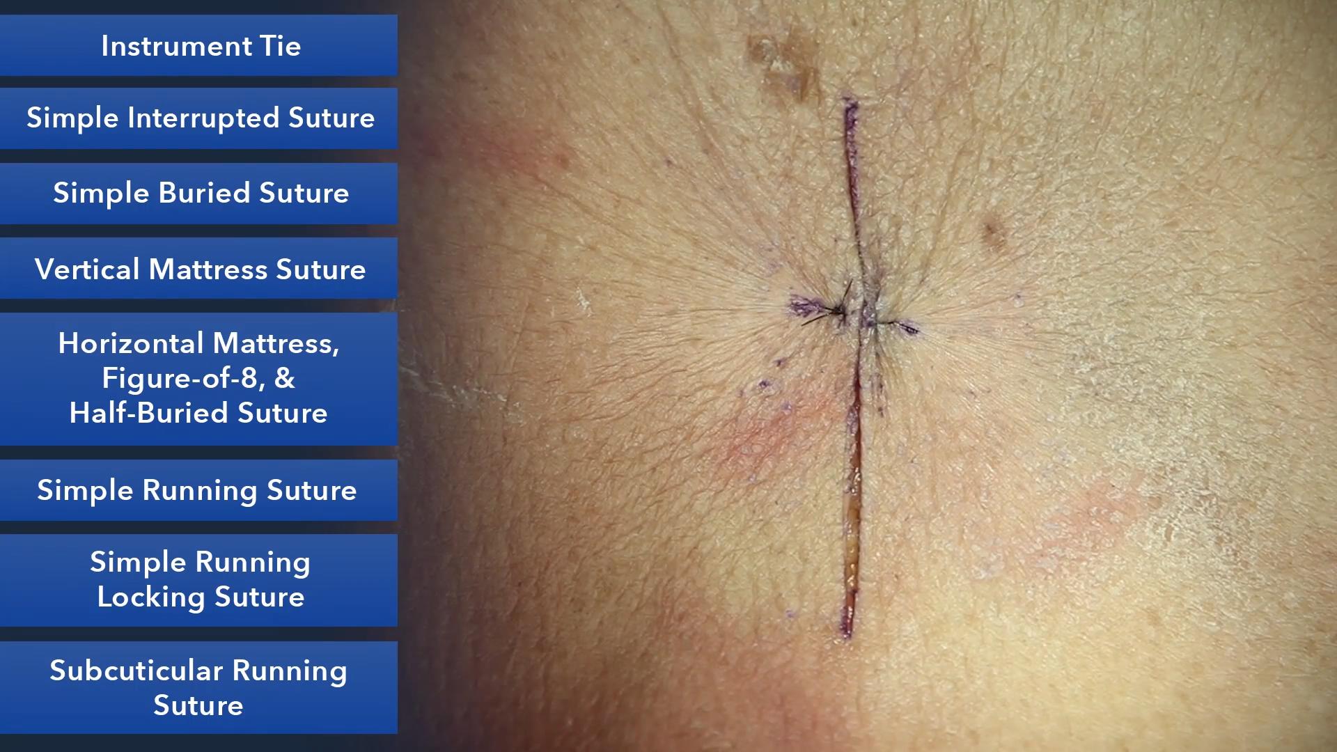 Duke_Suture_Skills_Course_1080p_20210830204043