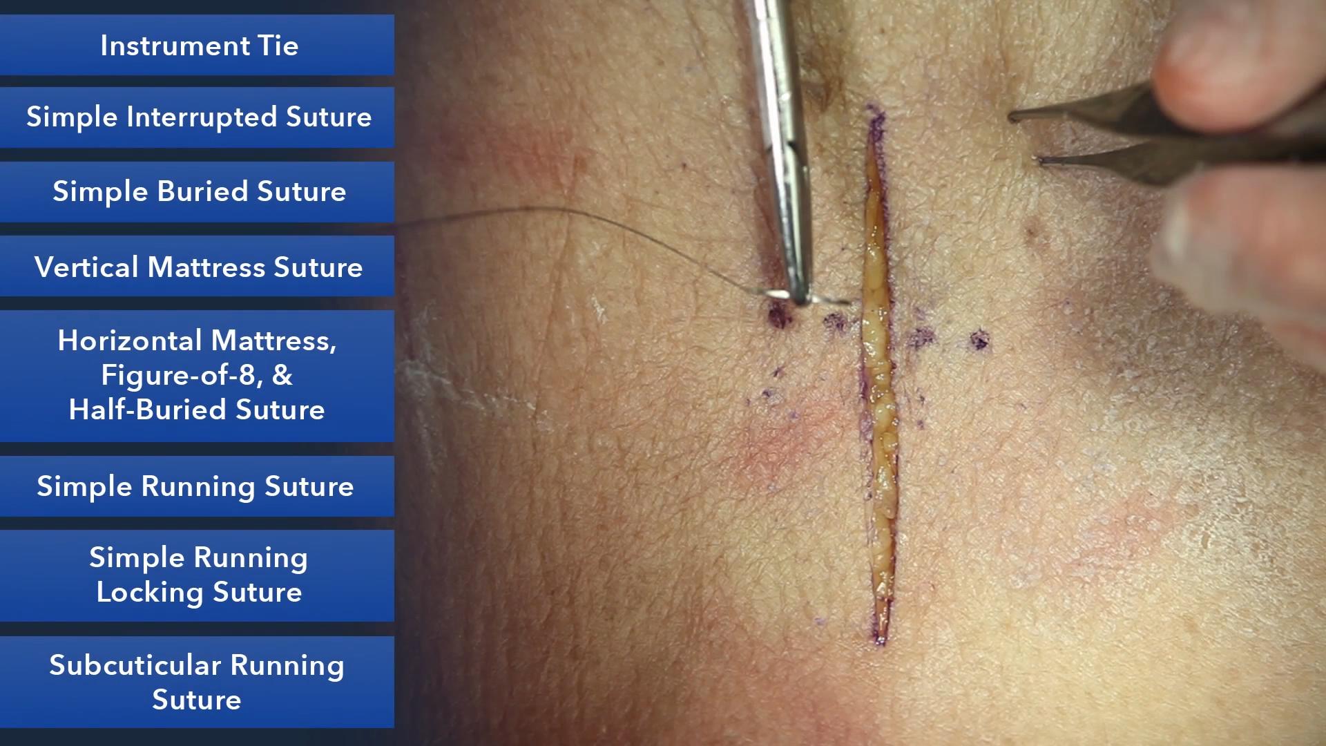Duke_Suture_Skills_Course_1080p_20210830204439