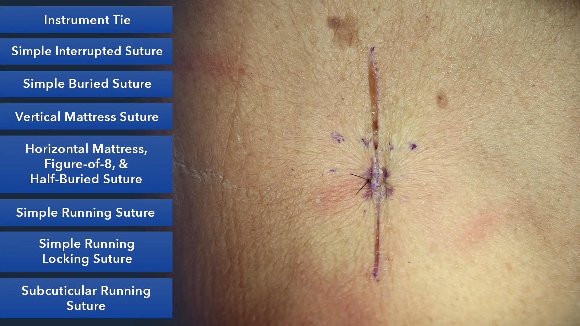 Duke_Suture_Skills_Course_1080p_20210830204722