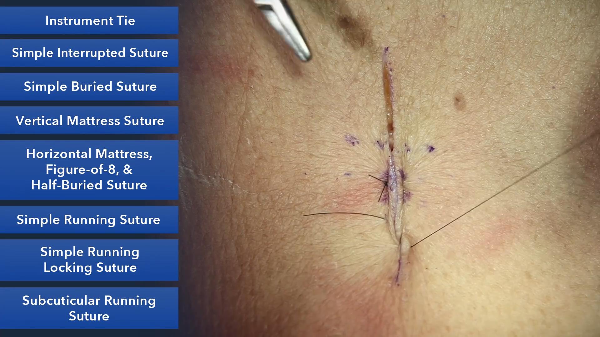Duke_Suture_Skills_Course_1080p_20210830204940