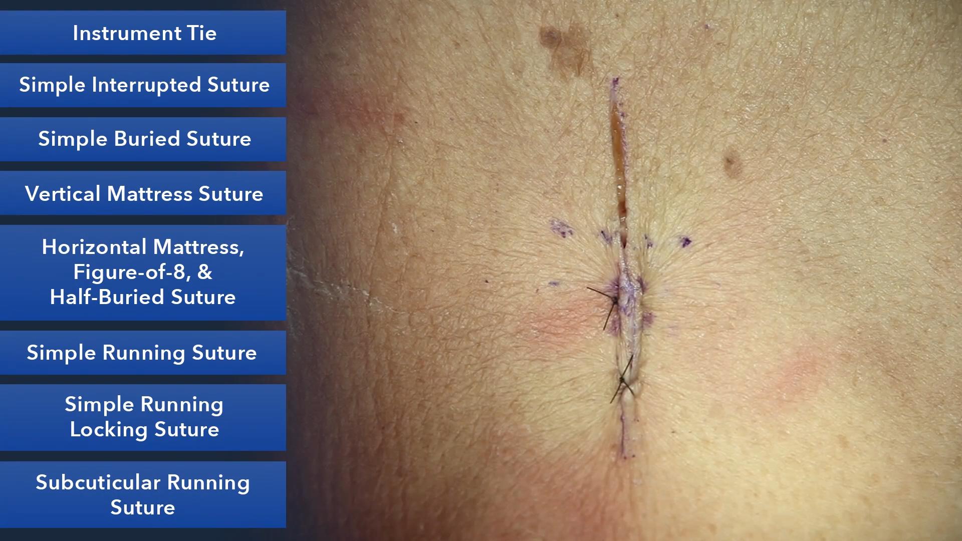 Duke_Suture_Skills_Course_1080p_20210830205152